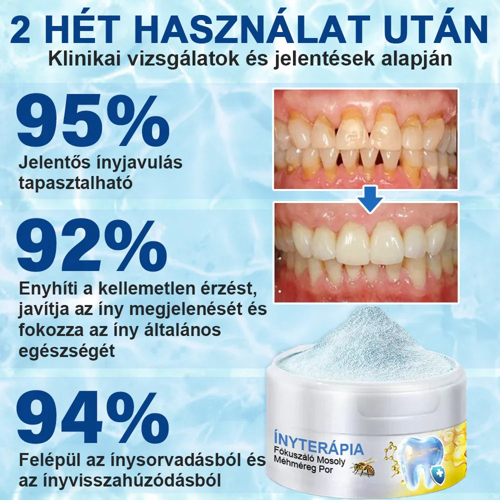 Furzero® 𝑭𝒐𝒄𝒖𝒔𝒔𝒎𝒊𝒍𝒆 – Méhméreges szájápoló por 🦷🦷